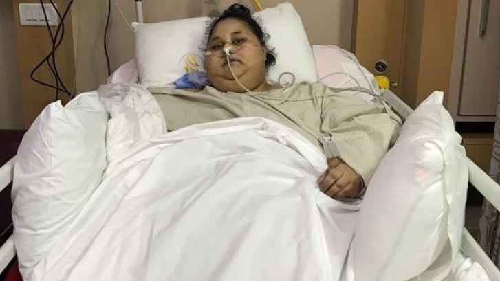 La mujer más gorda del mundo se somete con éxito a una operación de reducción de estómago en India
