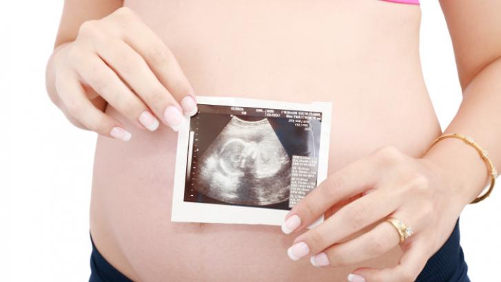 Ley de plazos del aborto: hasta cuándo se puede abortar y otras claves de la norma vigente