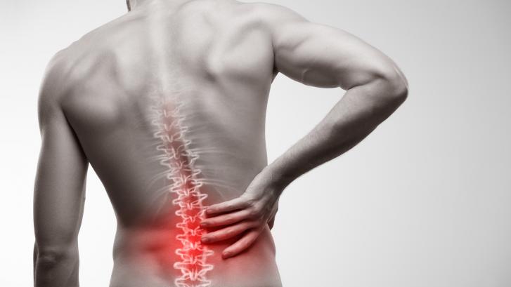Cinco cosas que debería saber sobre el dolor de espalda