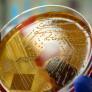 Las infecciones estreptocócicas graves alcanzan un nuevo récord en Japón
