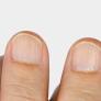 Estas son las posibles causas de tener muchas rayas en las uñas