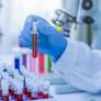 Una investigación española revela un 'código de barras' para entender cómo envejece la sangre