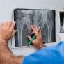 Le hacen radiografías de cadera en dos hospitales distintos: "Tienes dos caderas y debería tratarlas a la vez"
