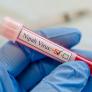 La OMS pone el foco en el virus del Nipah tras la muerte de una joven de 18 años
