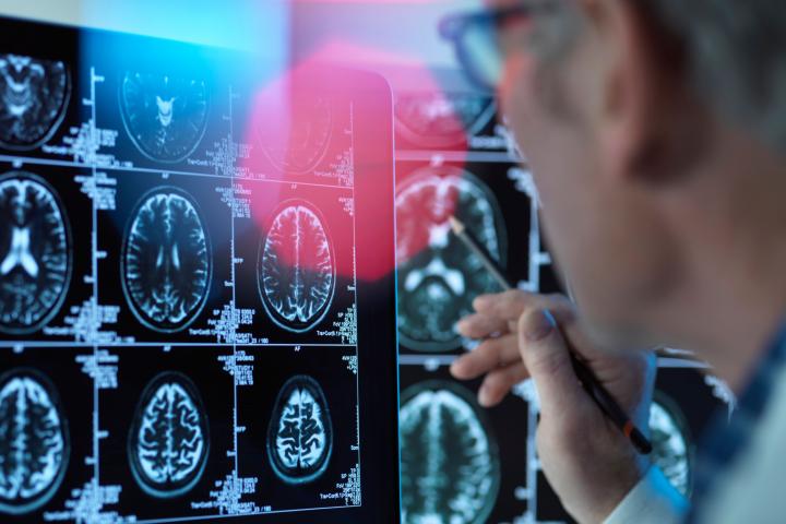 Doctor viewing brain scans for possible disease or damage in clinic