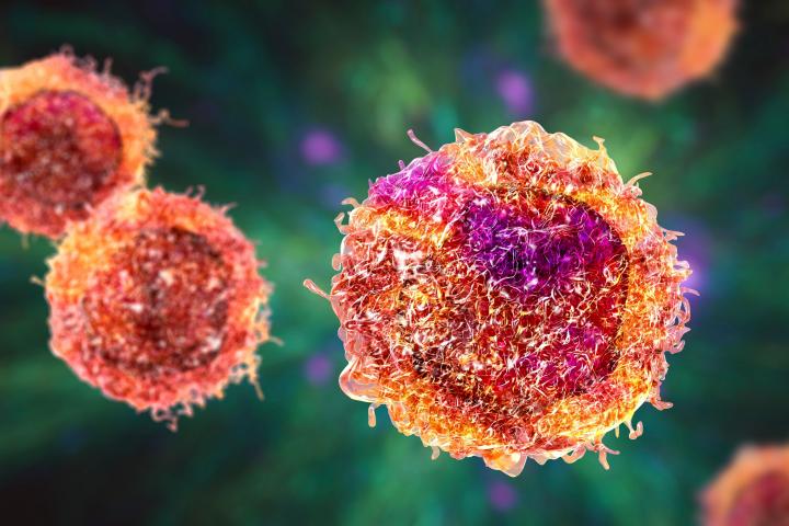 Ilustración de una célula cancerígena