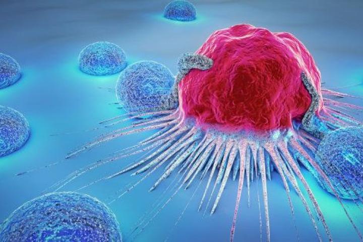 Célula cancerígena rodeada de linfocitos.