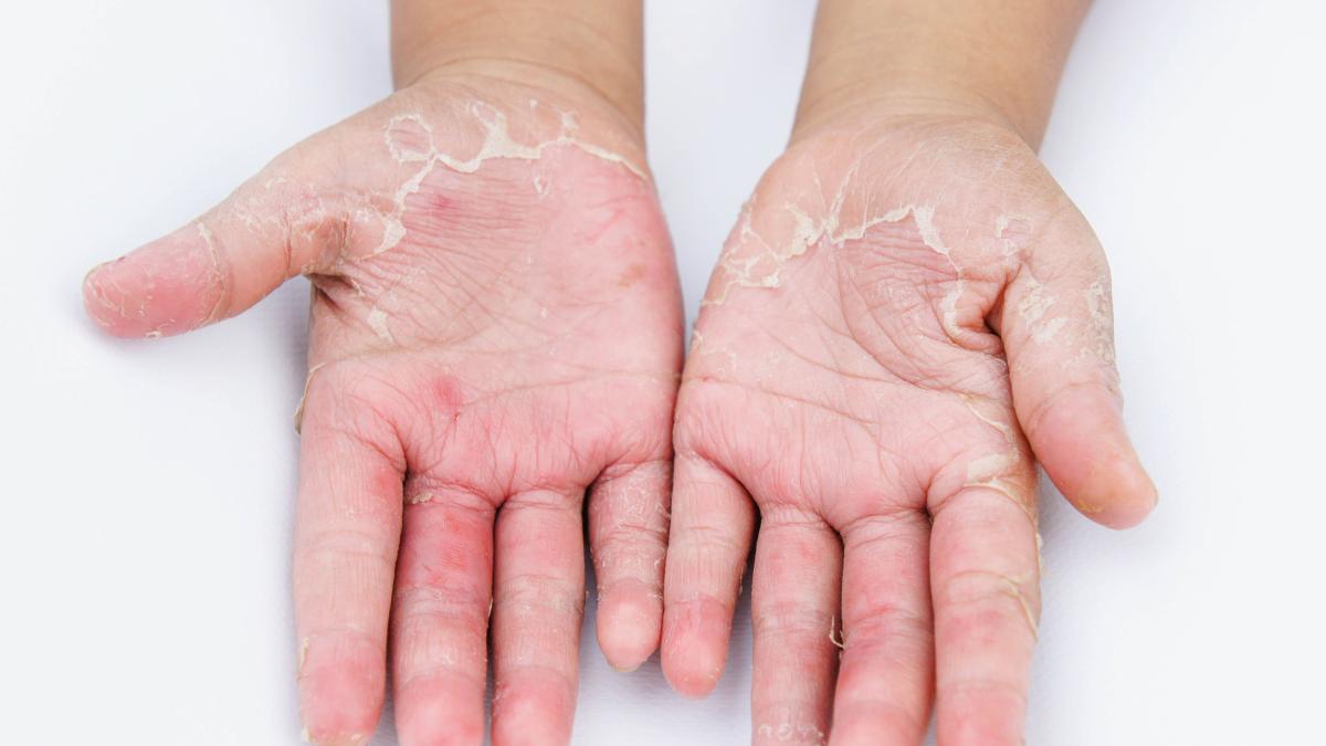 Cómo usar el gel hidroalcohólico en los niños - Criar con Sentido Común