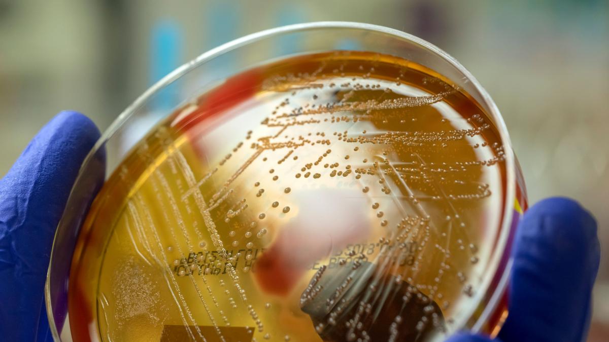 重篤な溶連菌感染症が日本で新記録を更新