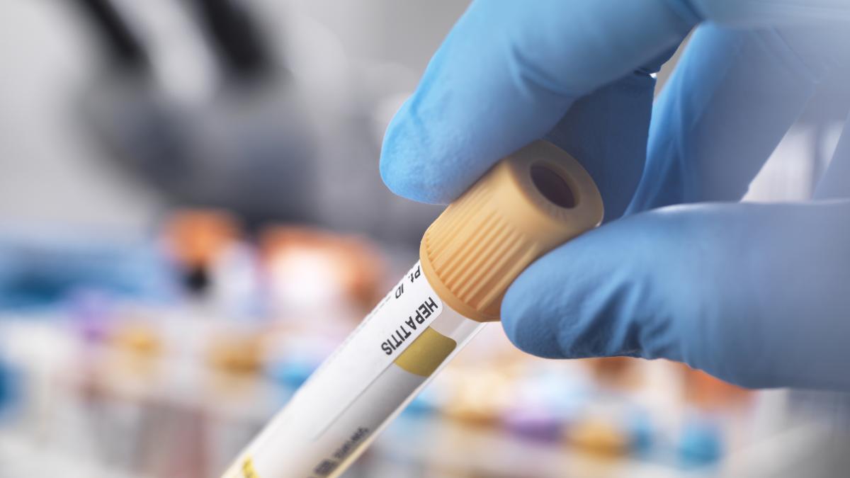 Salud investiga un posible brote de hepatitis A en Jumilla (Murcia)