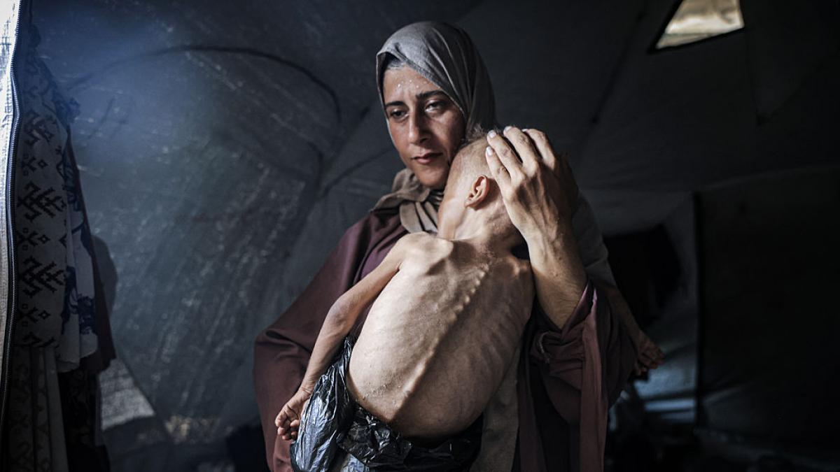 La denuncia de cien ONG: los habitantes de Gaza se están &quot;consumiendo&quot; a medida que se extiende la &quot;hambruna masiva&quot;