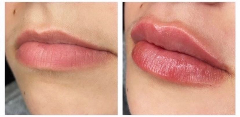 Sky Lane se ha sometido a una cirugía estética en los labios para darles más grosor y está ahorrando para otras operaciones.