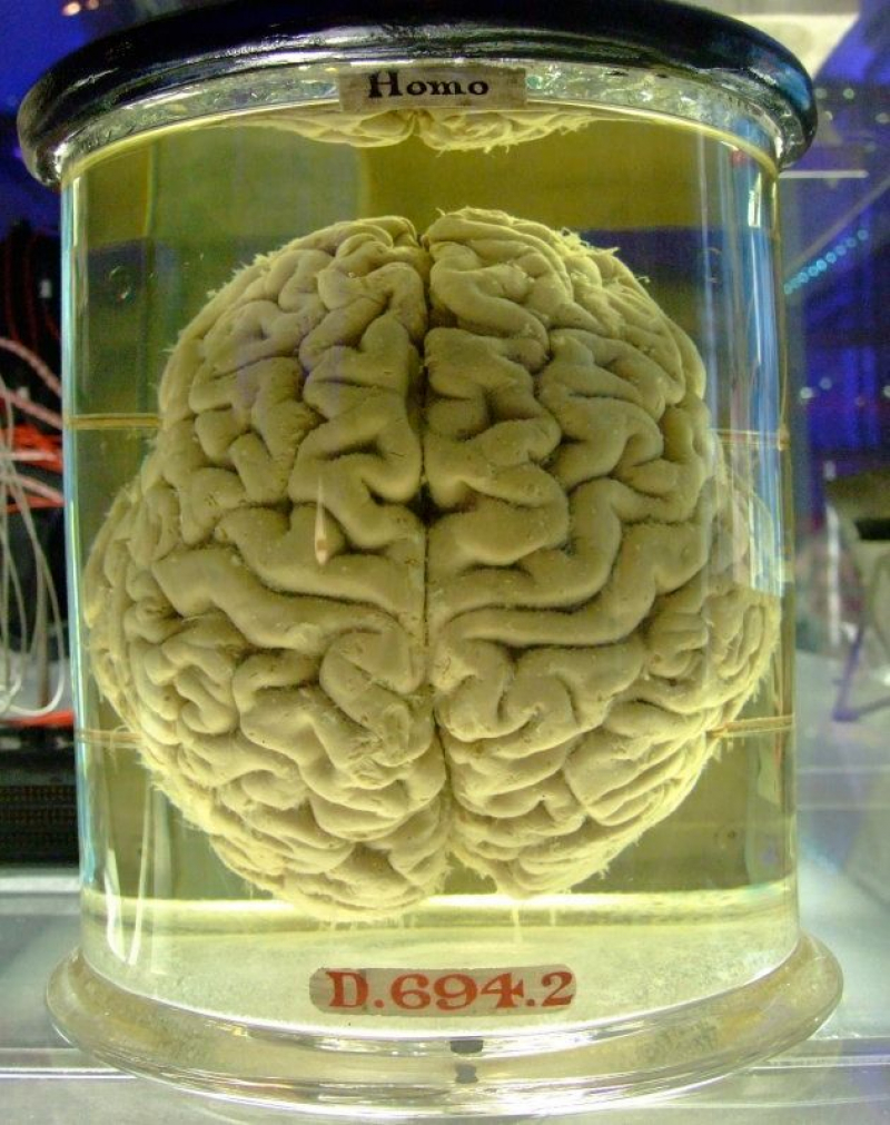 Cerebro humano conservado en formol.